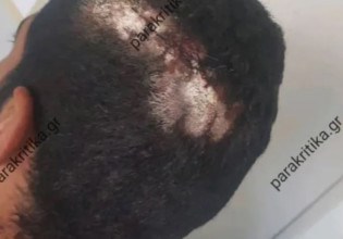 Χανιά: Ζήτησε από τον εργοδότη τα λεφτά του και εκείνος τον… έσπασε στο ξύλο