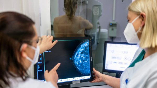 Πρόγραμμα «Φώφη Γεννηματά»: Εστάλησαν ήδη 1.000 SMS για δωρεάν προληπτική μαστογραφία