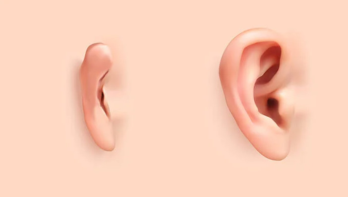 ΗΠΑ: Αμερικανοί γιατροί μεταμόσχευσαν σε ασθενή με μικρωτία ένα αυτί δημιουργημένο από τα κύτταρά του