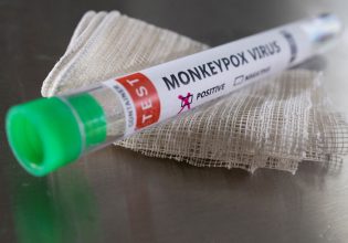 Ευλογιά των πιθήκων: Ενδείξεις ότι τα συμπτώματα έχουν αλλάξει στην πρωτοφανή επιδημία