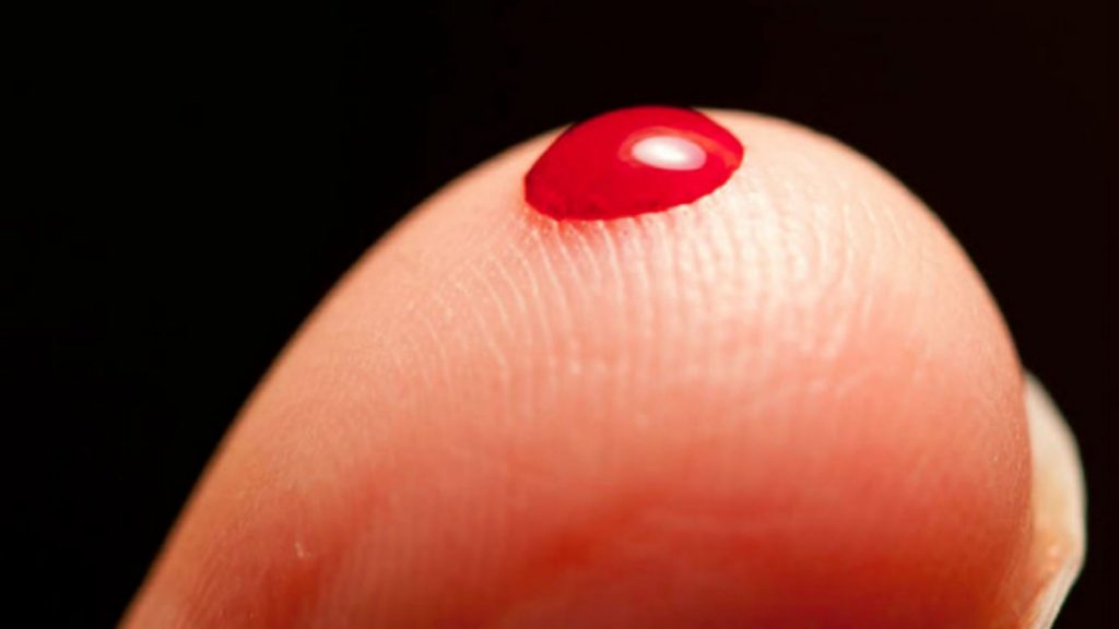 Αιμορροφιλία: «Ριζοσπαστική» γονιδιακή θεραπεία υπόσχεται ίαση της γενετικής ασθένειας