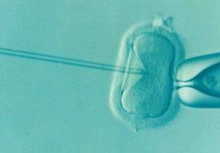 Στα 54 το νέο όριο ηλικίας για υποβοηθούμενη αναπαραγωγή