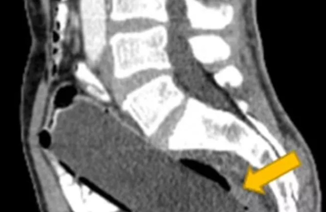 Η απίστευτη ιστορία ενός άνδρα: Το ιατρικό… πρόβλημα και ο φόβος να το πει στη γυναίκα του