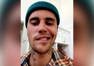 Τζάστιν Μπίμπερ: Τα νεότερα για την κατάσταση της υγειάς του μετά την παράλυση του προσώπου του