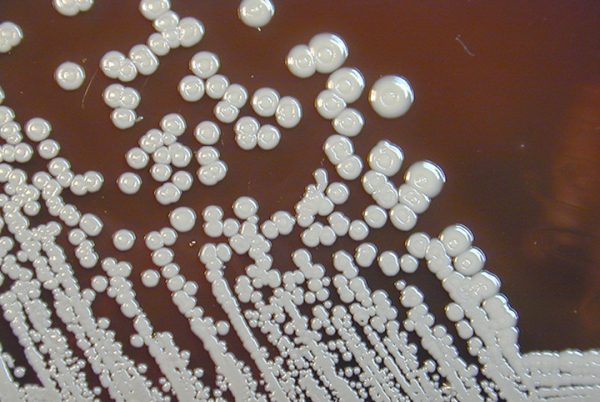 Μελιοείδωση: Βακτήρια της σπάνιας αλλά θανατηφόρας λοίμωξης εντοπίστηκαν στις ΗΠΑ