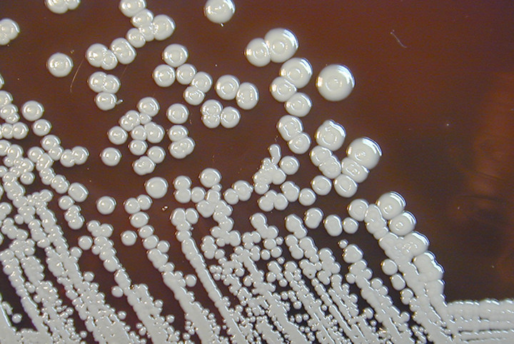 Μελιοείδωση: Βακτήρια της σπάνιας αλλά θανατηφόρας λοίμωξης εντοπίστηκαν στις ΗΠΑ