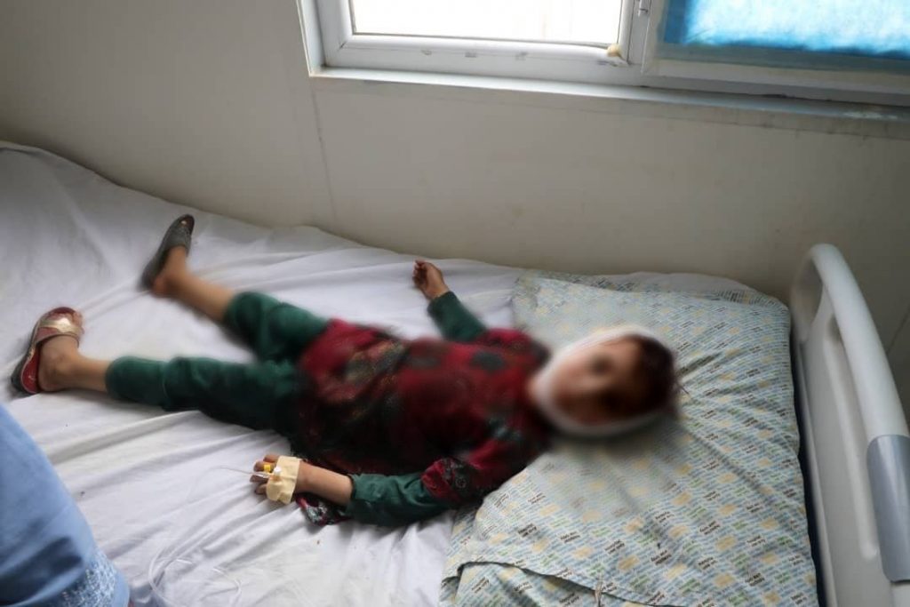 Αφγανιστάν: Σκοτώθηκαν 2 παιδιά και άλλα 8 τραυματίστηκαν – Επαιζαν με όλμο