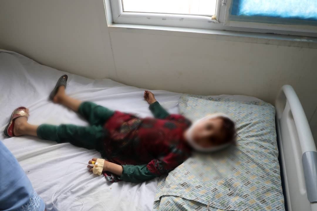 Αφγανιστάν: Σκοτώθηκαν 2 παιδιά και άλλα 8 τραυματίστηκαν - Επαιζαν με όλμο