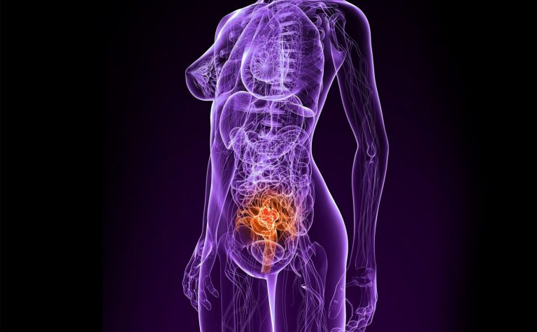 Υπουργείο Υγείας: Ερχονται δωρεάν εξετάσεις για τον καρκίνο του τραχήλου της μήτρας