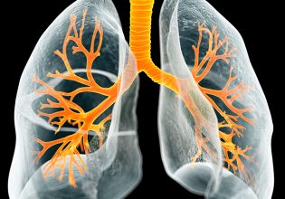 Διπλή ανοσοθεραπεία για τον ανθεκτικό καρκίνο του πνεύμονα