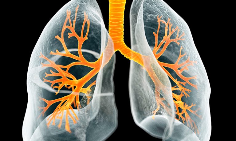 Διπλή ανοσοθεραπεία για τον ανθεκτικό καρκίνο του πνεύμονα