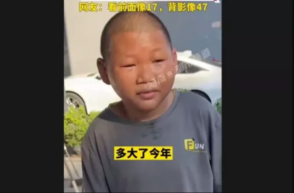 Μάο Σένγκ: 27χρονος μοιάζει με 10 ετών και δε μπορεί να βρει δουλειά