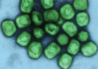 Ευλογιά των πιθήκων: Πόσο πρέπει να ανησυχούμε;