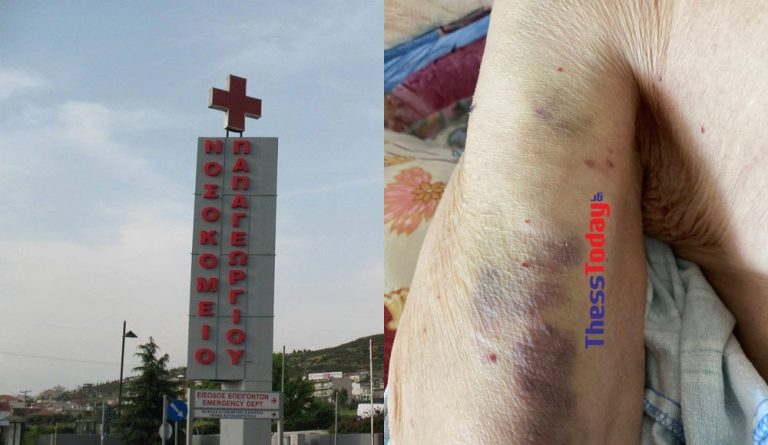 Θεσσαλονίκη: Τι απαντά το νοσοκομείο στην καταγγελία για κακοποίηση 98χρονου – «Έζησαν έναν εφιάλτη», λέει ο ίδιος