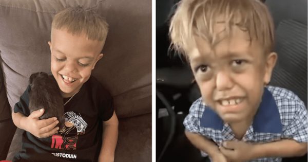 Ο 11χρονος με νανισμό που δεχόταν άγριο bullying αρχίζει καριέρα στο Χόλιγουντ