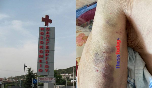 Θεσσαλονίκη: Καταγγελία δημοσιογράφου για κακοποίηση του πατέρα του στο Νοσοκομείο «Παπαγεωργίου»