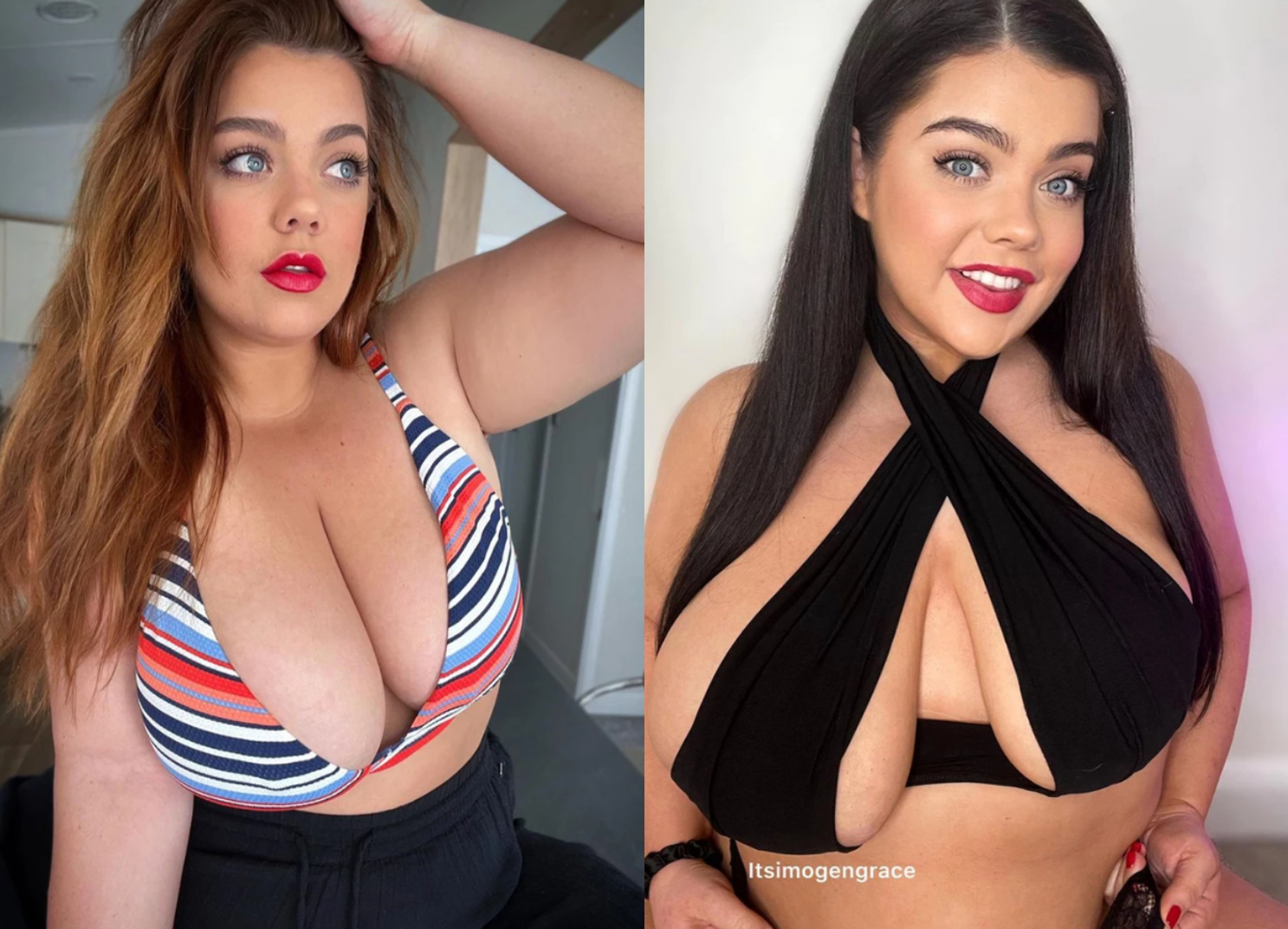 Viral η 26χρονη που το ένα στήθος της είναι διπλάσιο από το άλλο - «Δεν ενοχλεί τους συντρόφους μου»