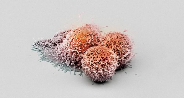 Καρκίνος: Έξι ιοί που μπορούν να τον προκαλέσουν