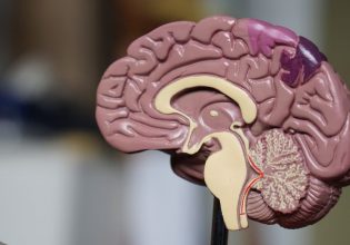 Έρευνα: Γιατί οι πολύ αδύνατοι άνδρες κινδυνεύουν από άνοια (περισσότερο ακόμη και από τις υπέρβαρες)