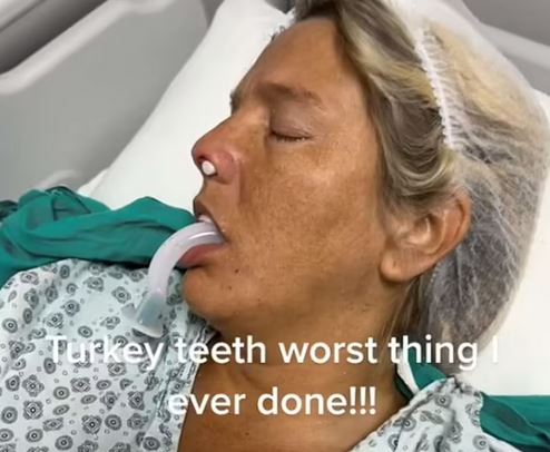 Βρετανία: 35χρονη πήγε να φτιάξει τα δόντια της στην Τουρκία και περιγράφει τη φρίκη που έζησε
