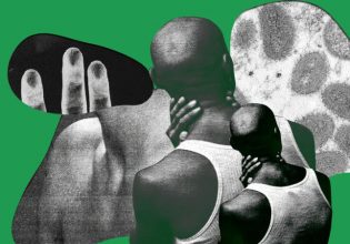 Επίθεση σε γκέι ζευγάρι: Τους αποκάλεσαν «ευλογιά των πιθήκων»