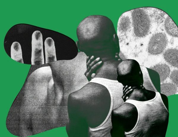 Επίθεση σε γκέι ζευγάρι: Τους αποκάλεσαν «ευλογιά των πιθήκων»