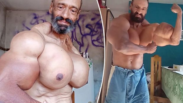 Πέθανε σε ηλικία 55 ετών ο Βραζιλιάνος «Hulk» – Έκανε ενέσεις λαδιού για να «φουσκώσει» τους μυς του