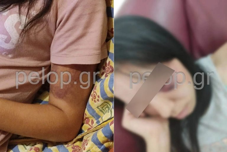 Σοκάρει υπόθεση κακοποίησης 16χρονης από τον σύντροφό της: Την απήγαγε και την ξυλοκόπησε δημόσια