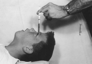 Λοβοτομή: Η σκοτεινή πλευρά της επιστήμης και το πιο αμφιλεγόμενο Νόμπελ Ιατρικής