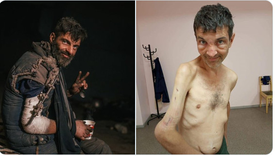 Ουκρανία: Η εικόνα «πριν» και «μετά» ενός Ουκρανού αιχμαλώτου αποτυπώνει τη φρίκη του πολέμου