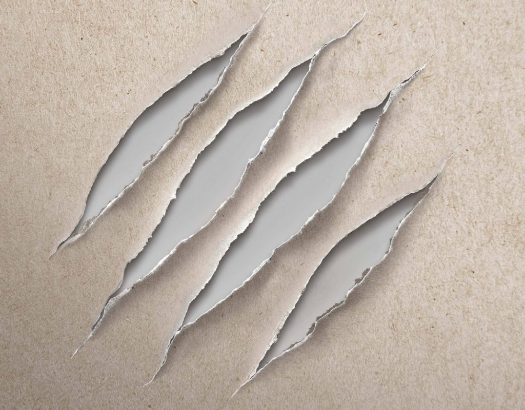 Δυσκολίες πρόσβασης σε νέες θεραπείες για ασθενείς με ατοπική δερματίτιδα