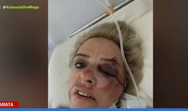 Καλαμάτα: Σοκάρει το βίντεο – ντοκουμέντο από την άγρια επίθεση αδέσποτων σε νεαρή γυναίκα