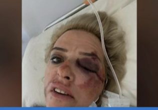 Καλαμάτα: Σοκάρει το βίντεο – ντοκουμέντο από την άγρια επίθεση αδέσποτων σε νεαρή γυναίκα