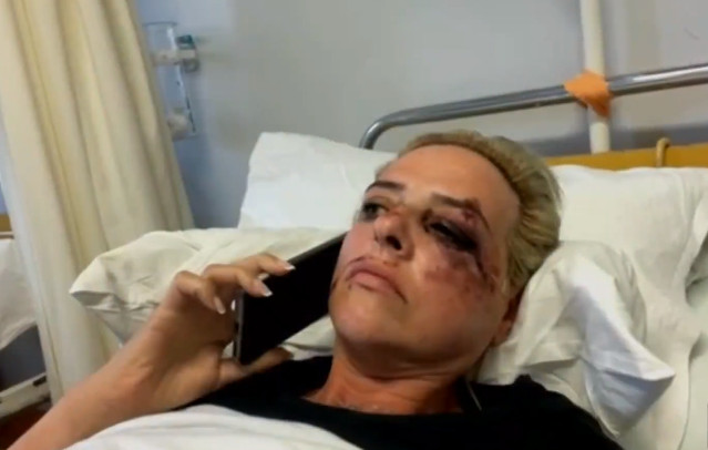 Καλαμάτα: Νέα επίθεση αδέσποτων σκυλιών – Στο νοσοκομείο το θύμα με σοβαρά τραύματα