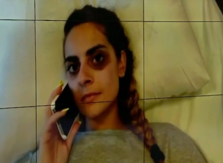 Ατύχημα στο Allou Fun Park: Βγήκε από την Εντατική η 21χρονη που τραυματίστηκε στο τρενάκι