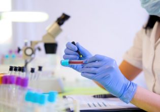 Μελέτη για τον καρκίνο: Σχεδόν οι μισοί θάνατοι μπορούν να προληφθούν