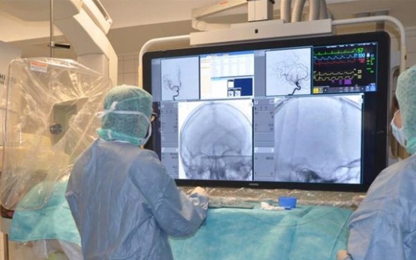 Μελέτη: Ποια ομάδα αίματος έχει μεγαλύτερο κίνδυνο για πρώιμο εγκεφαλικό