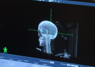 Εξάλειψαν το γλοιοβλάστωμα όταν του «έκοψαν» την τροφή