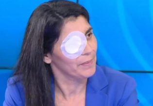 Μεσσήνη: «Ούρλιαζα, ήταν σαν να μου είχαν βάλει φωτιά» λέει η γυναίκα που δέχθηκε επίθεση με οξύ