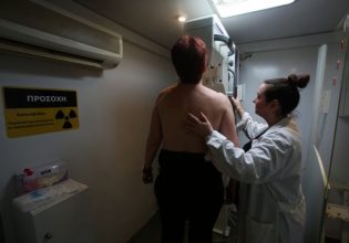Καρκίνος μαστού: Μικρότερος ο κίνδυνος για όσες γυναίκες ασκούνται περισσότερο