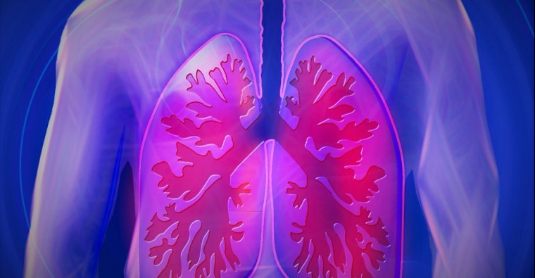 Ιδιοπαθής Πνευμονική Ίνωση: Μία χρόνια αναπνευστική νόσος που μπορεί να παραμείνει χρόνια