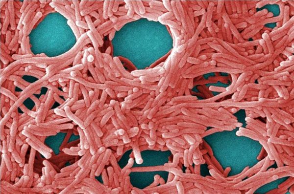 Αργεντινή: Η νόσος των λεγεωνάριων πίσω από τους «μυστηριώδεις» θανάτους 