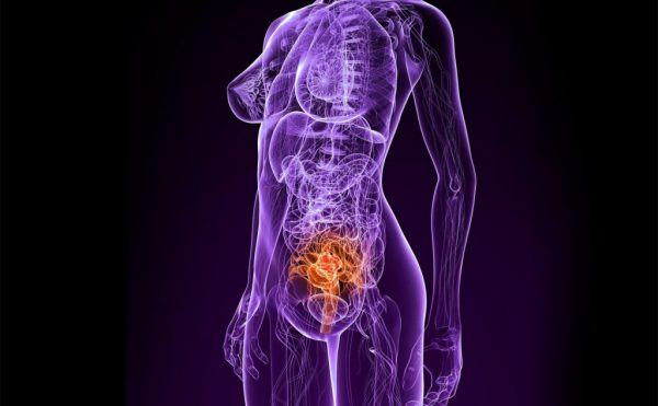 Πάνω από 1,3 εκατ. γυναίκες διαγνώστηκαν με γυναικολογικούς καρκίνους το 2020