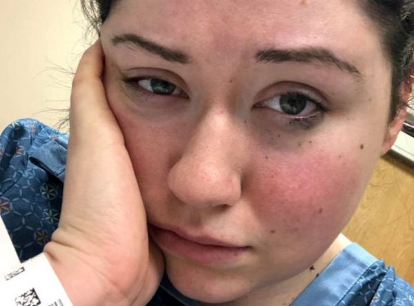 ΗΠΑ: Νεαρή γυναίκα έχει «αλλεργία στη βαρύτητα» και όλο το 24ωρο είναι στο κρεβάτι