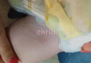 Ηράκλειο: Σοκαριστικές εικόνες από την επίθεση του σκύλου σε μωρό που ήταν στην αγκαλιά της γιαγιάς του