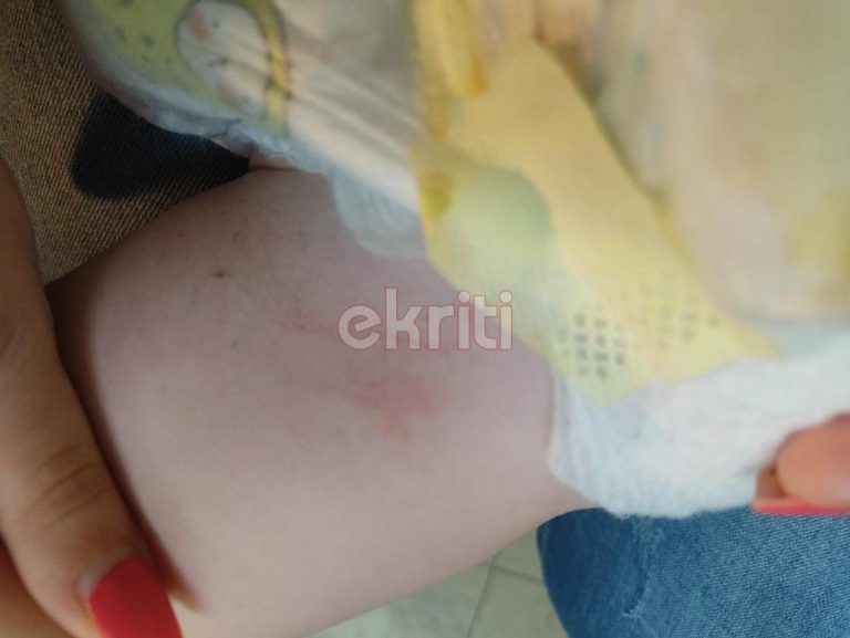 Ηράκλειο: Σοκαριστικές εικόνες από την επίθεση του σκύλου σε μωρό που ήταν στην αγκαλιά της γιαγιάς του