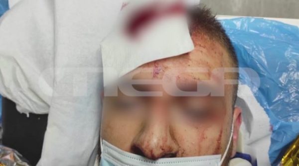 Allou Fun Park: «Δεν ήταν κανείς μας όρθιος» υποστηρίζει ο 25χρονος τραυματίας