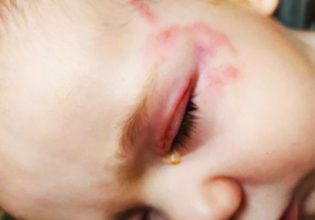 Ηράκλειο: Συγκλονίζει ο πατέρας του μωρού που δάγκωσε ο σκύλος