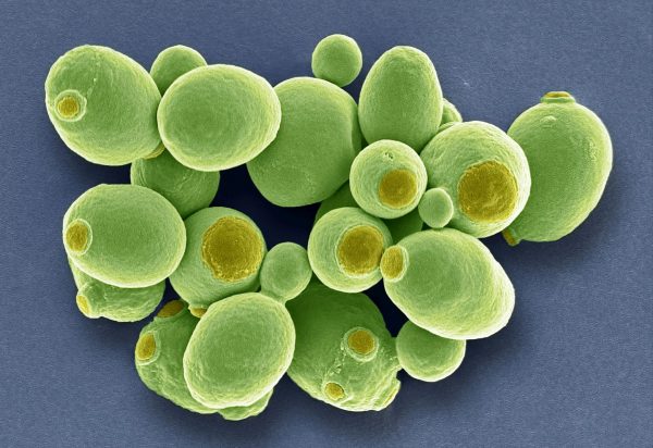 Καρκίνος: Μυστηριώδεις μύκητες βρέθηκαν να αναπτύσσονται μέσα στους όγκους