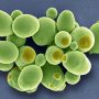 Καρκίνος: Μυστηριώδεις μύκητες βρέθηκαν να αναπτύσσονται μέσα στους όγκους